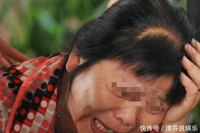 下达|宝宝拍完百天照，医院下达病危通知为了纪念，你可能是害了孩子