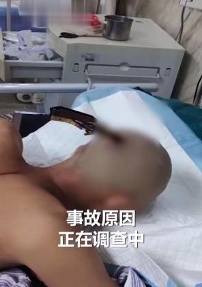  自行|天降飞刀插中后脑勺，男子居然自行走上救护车……