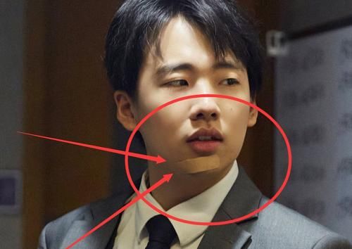 受伤|郭麒麟录《密室》意外受伤,看到邓伦的反应,真的太暖心了