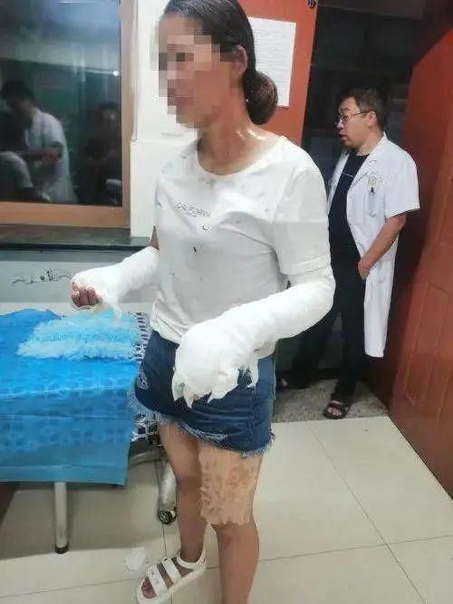  气球|这款常见玩具突然爆炸！7人被烧伤！提醒：已上“黑名单”