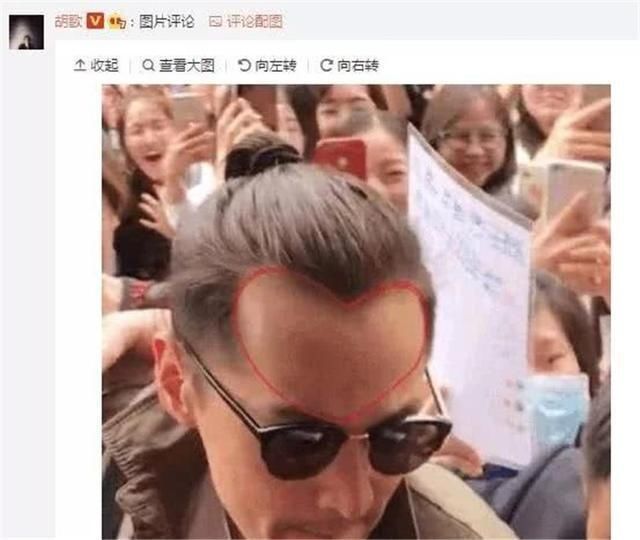  何炅太|当男明星发际线后移，何炅太喜感，胡歌简直没眼看