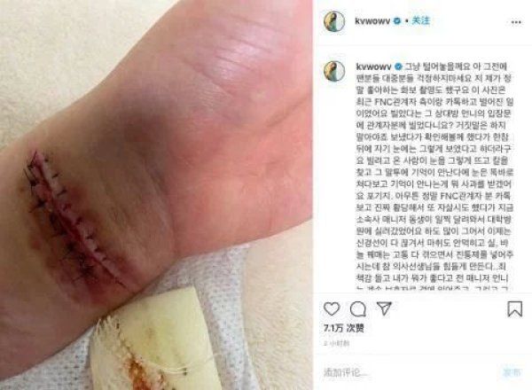 无辜|没有一片雪花是无辜的！权珉娥再次自杀送医！割腕太多次神经断裂