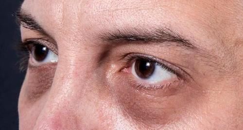  改掉|肝脏不好的人，“脸上”有4种表现！5件“伤肝”的习惯要改掉