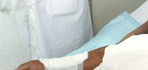  车上|一根“枯树枝”挂在车上, 司机伸手拿掉, 结果进医院抢救