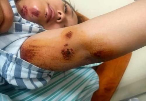 悬崖|3岁儿子景区小便,母亲被推下20米悬崖,索赔150万?警方回应!