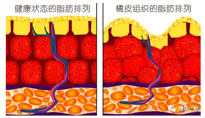  训练|赵丽颖身材都练得这么好了，还有网友喷她是奚梦瑶同款扁平臀？！