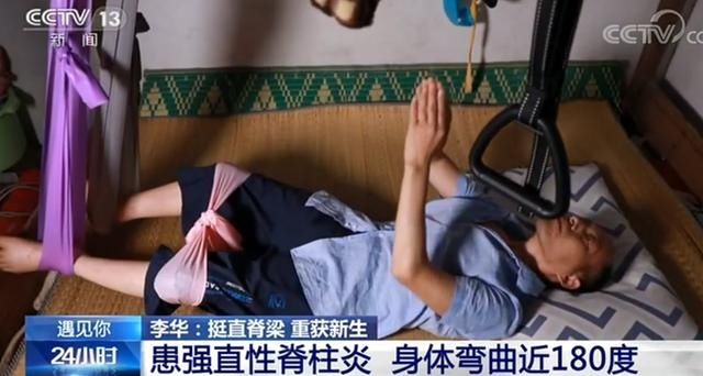  终于|身体被敲断四次后他终于重新站起！网友泪目