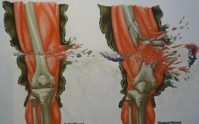 弹射|被子弹射中究竟是什么感觉?大家别再被电影给欺骗了!