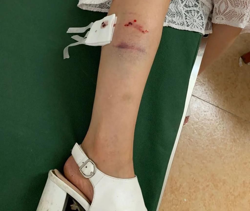  姑婆|危险！姑婆山里的“大师兄”进入狂暴模式，疯狂抢夺市民食物还把人伤了！