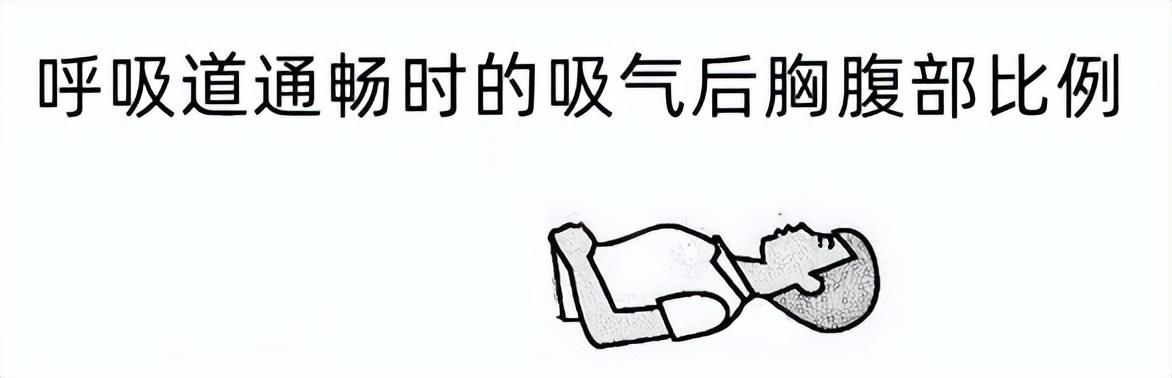 延迟性呼吸抑制(【经验分享】延迟性呼吸抑制致“呼吸反常”)