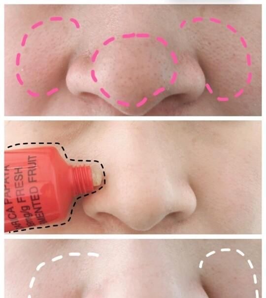 绿豆泥面膜|发现鼻子上的小颗粒越来越多,怎么办?