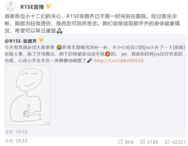  假发|爱豆出糗瞬间：王一博追星失控，孟美岐甩飞假发片，周震南被猫咬