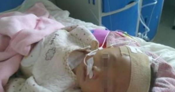  孩子的头|因为父亲的一个小动作，2岁宝宝就成为了植物人，大家一定要谨记