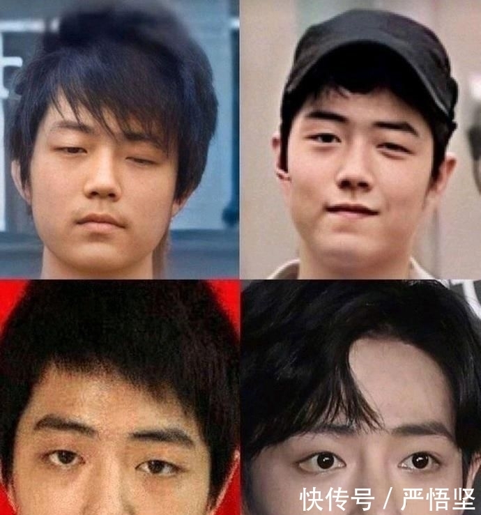 照曝光|肖战早年素人照曝光:整容实锤?