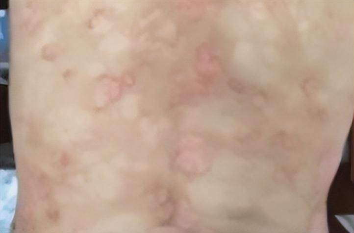 介入医学科可以治疗皮肤病吗(麻醉科治皮肤病？胡闹、还是确有根据？)