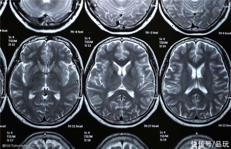 人工智能能超越人类的大脑(神经科学家在 CNN 记者身上测试读脑人工智能)