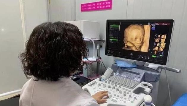 天才胎儿火了,在子宫里掰手指算数,医生