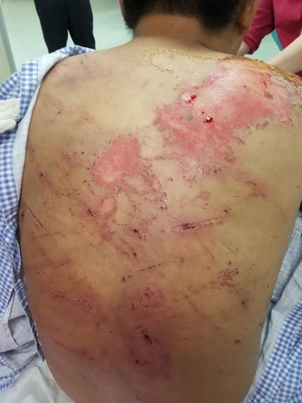 姓男子|台湾夫妻为讨5000元债务 竟押人淋油虐烧囚禁10天