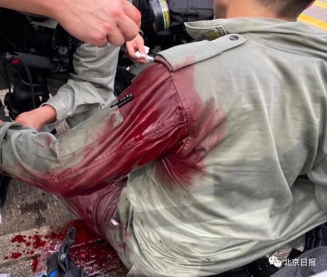  呵呵|呵呵！刺伤港警男子潜逃最终目的地竟是台湾，没想到……