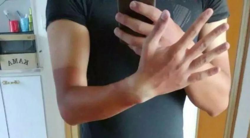  跑步|夏季跑步，请避开这些误区!