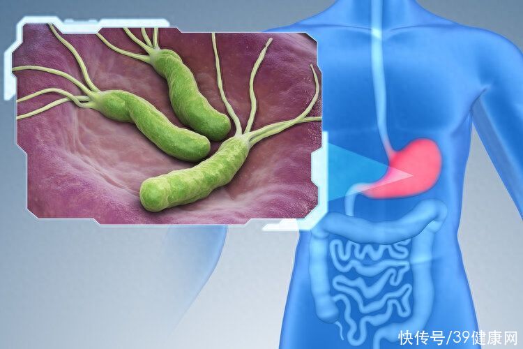 口臭“根源”找到了？近7亿中国人感染，提醒：小心这6种症状2023
