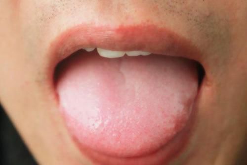  生病|舌头是身体晴雨表，哪些变化，说明你可能生病了？自测一下