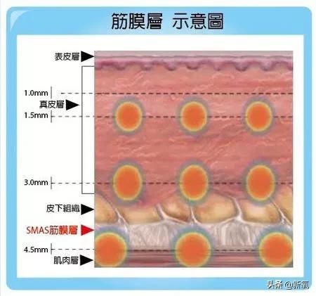  产后|高圆圆复出有点坎坷，产后1年首次亮相网友们为这生图吵翻天