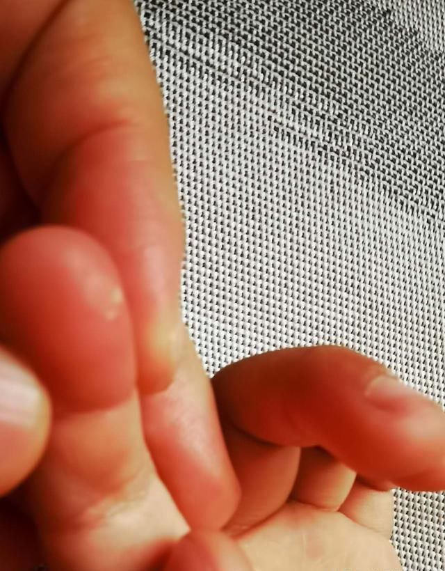 温顺|再温顺的宠物,也有可能伤到宝宝,饲养前想清楚3件事再做决定