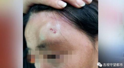 驾驶员|只因劝他戴口罩，男子暴打女司机！