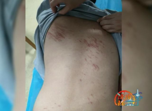  托举|女子深夜跳海，小伙跳水救人，水下托举半小时，浑身被划伤……