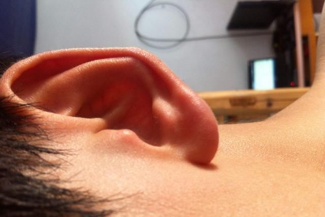  耳屎|为什么有的人耳屎是干的，有的人耳屎是湿的？原因有3点