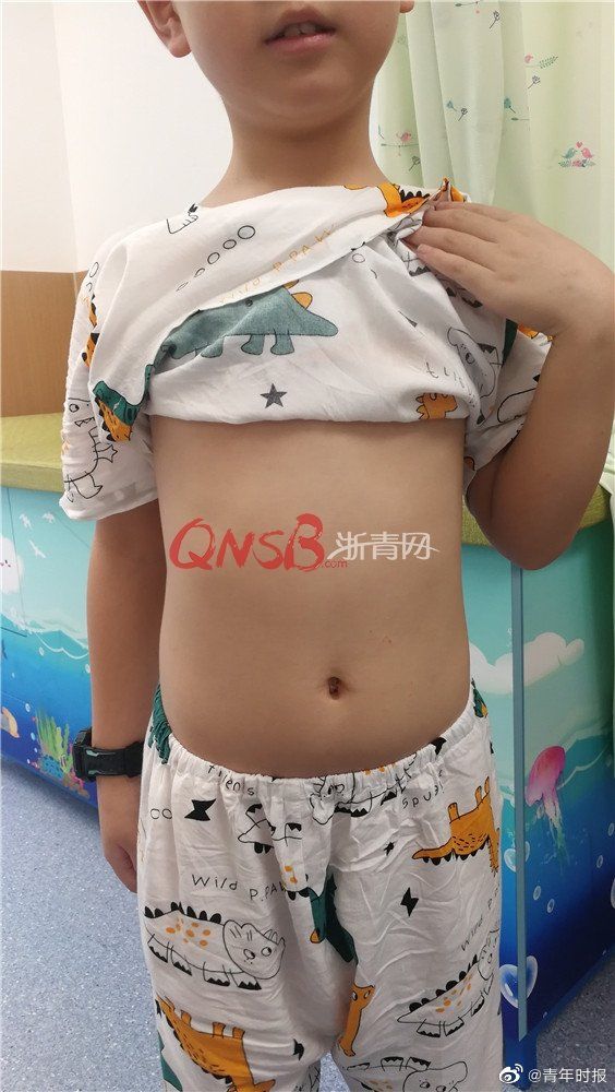 毫升|每晚100毫升啤酒连喝一个月，8岁男孩脸色越来越黄，差点没命