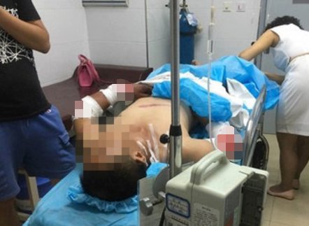 妻子|女护士与男医务同居,丈夫发现后持刀砍人,造成一死一伤