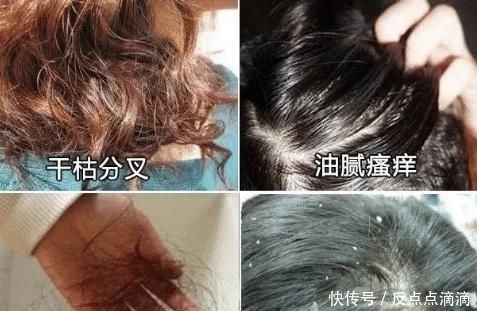 掉头发|掉头发是因压力大?看了袁咏仪的护发秘籍,原来一直都做错了!