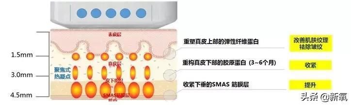  产后|高圆圆复出有点坎坷，产后1年首次亮相网友们为这生图吵翻天