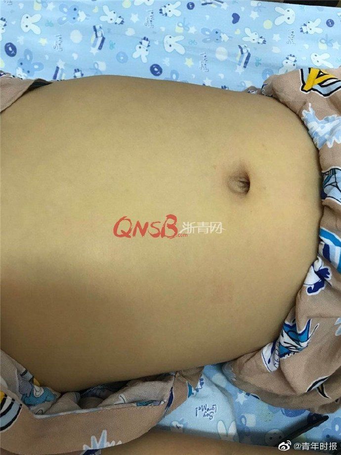 毫升|每晚100毫升啤酒连喝一个月，8岁男孩脸色越来越黄，差点没命