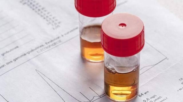  尿少|喝完水后，有的人频繁小便，而有的人却尿少，谁更健康？不妨了解