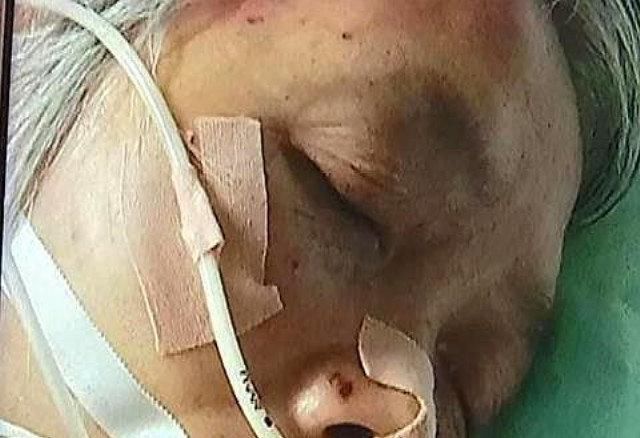  索赔|老人在超市偷东西被抓，5分钟后突然发病，家属索赔16万元