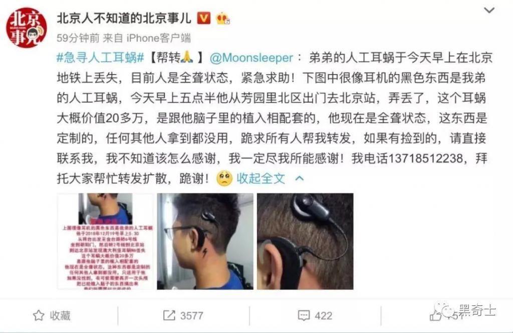 假话|天价耳蜗案判决：说真话的要赔说假话的1万元，我不服