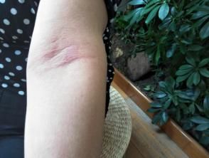 部位|怎样坚持拍打同一个部位一小时?