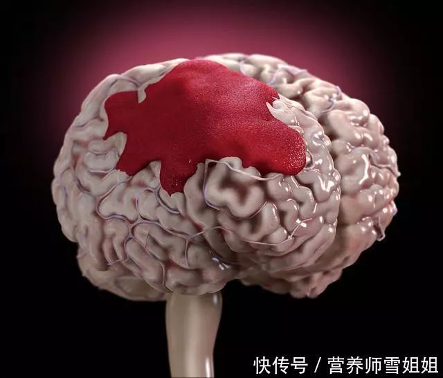  医生|28岁男子，拍婚纱照晕倒，医生查明原因后，准新娘说啥不嫁了