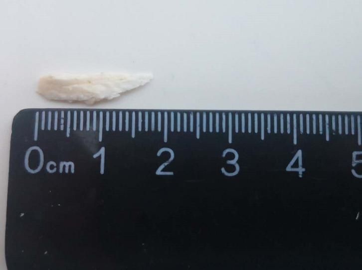  面汤|喂7个月大幼儿喝面汤，竟让这个东西卡进气管！