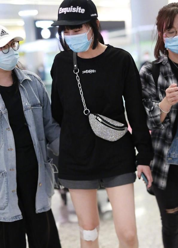 助理|黄龄摔下舞台后首现身,腿部一大片擦伤令人心疼,走路需助理搀扶