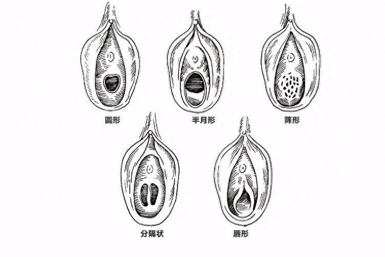 阴部颜色深是什么原因(女性私处颜色深，是“经历”太多了？排查这4个原因，别想歪了)