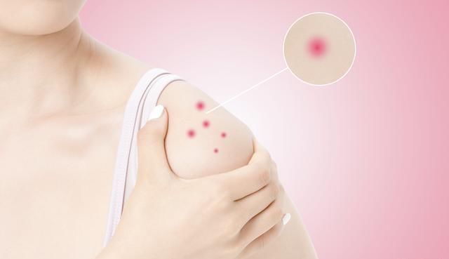 预警|14种并发症预警信号,糖友一定不要忽视!