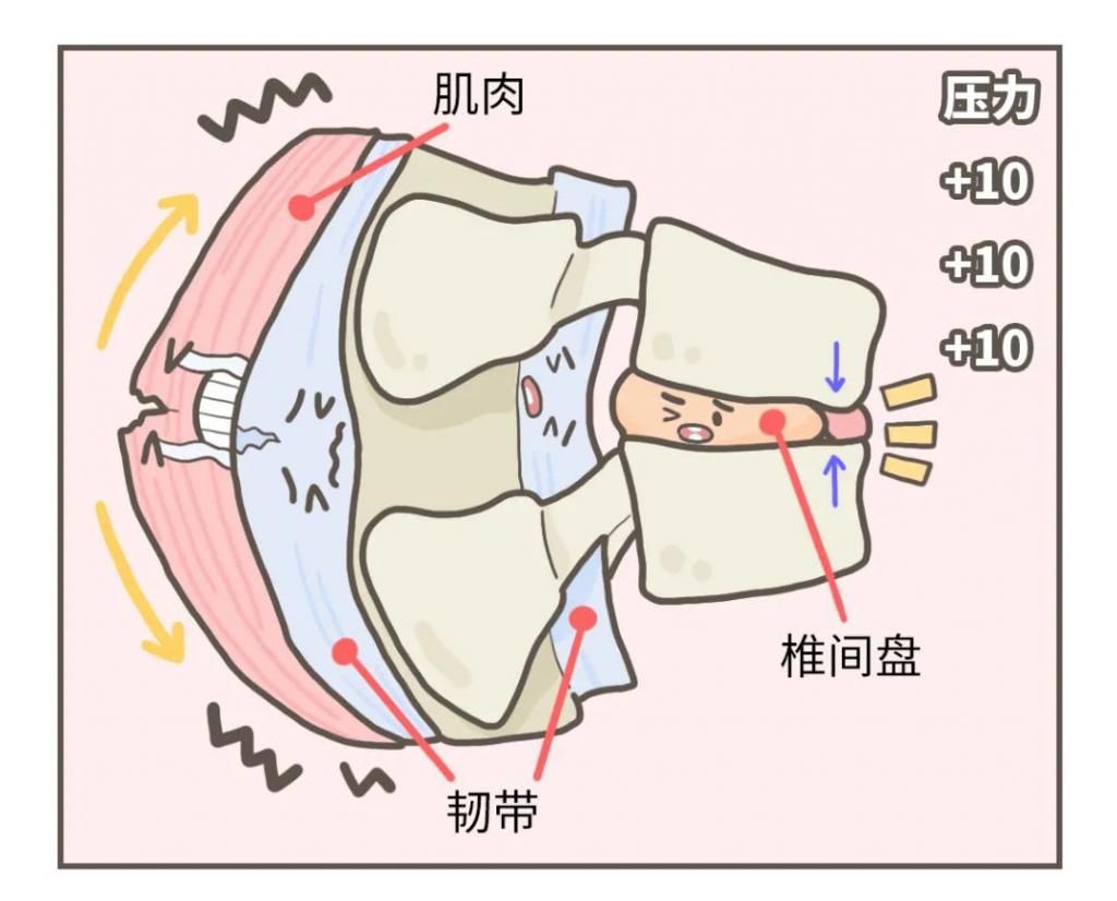 韧带和肌肉|一个伤腰的姿势，你可能每天都在做