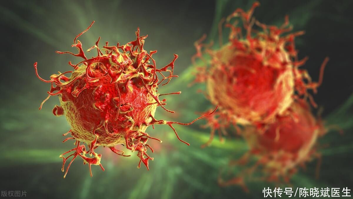 最容易拖成癌的六种小病(提醒：5种“小病”最易拖成癌症，避免惹癌上身，做到4点)