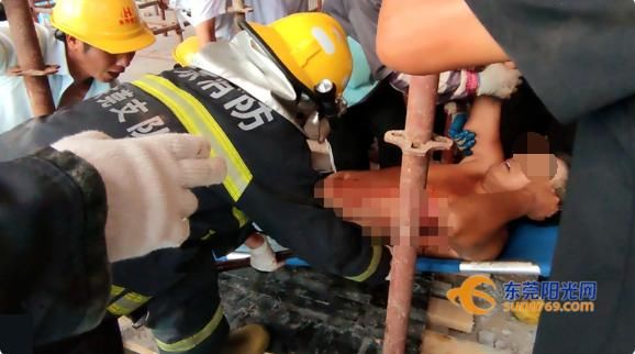  男子|【吓人】离心脏只差几厘米！ 男子在工地坠落 ，4根钢筋插穿身体....