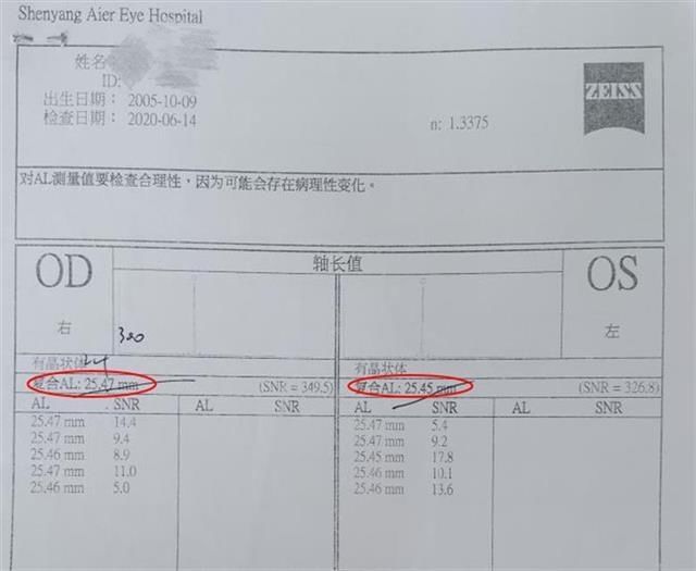 近视|低度数隐藏大危害!8岁女童眼睛里竟长出“豹纹”