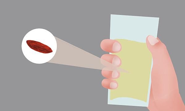  运动|肝脏变“脏”的表现有哪些？如何才能给肝脏“洗个澡”？